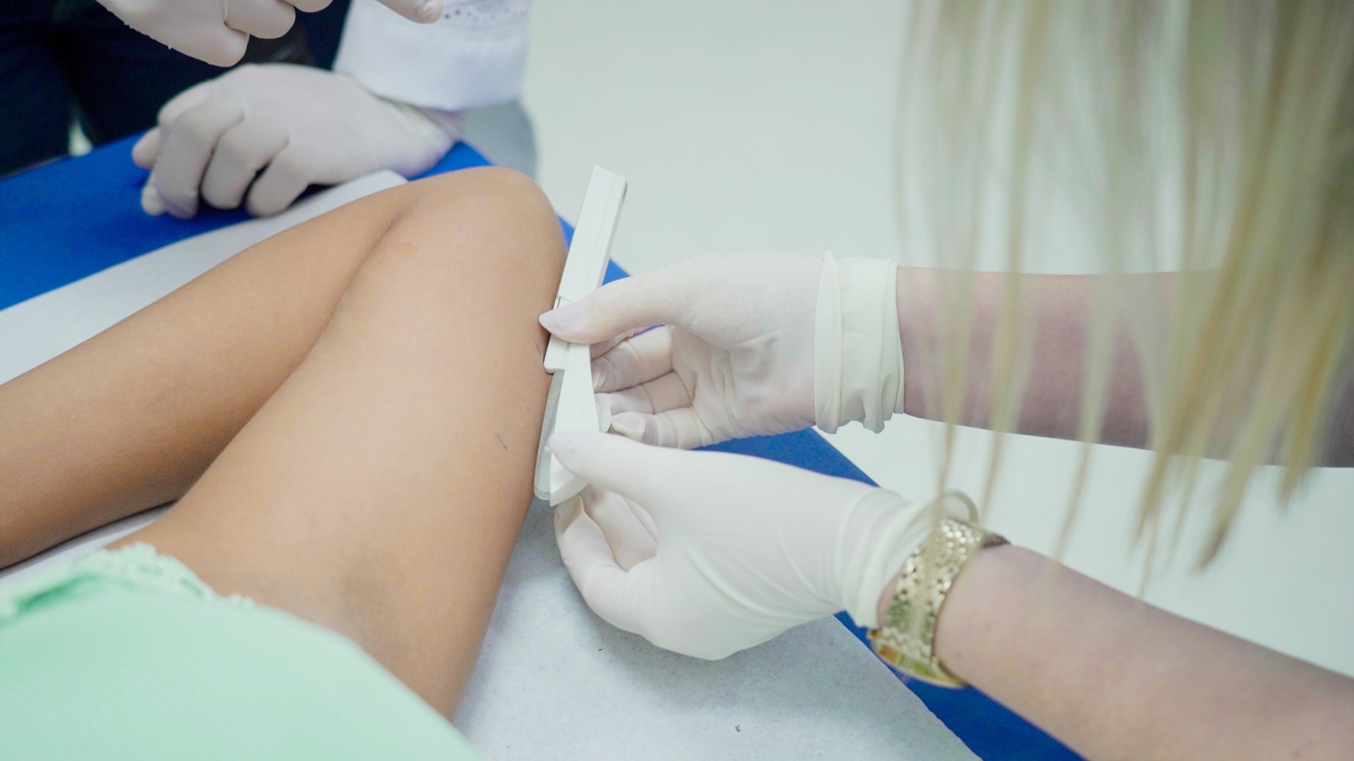 Fortaleza Distribui Mais de 600 Implantes Contraceptivos para Adolescentes em Ação Contra Gravidez Precoce