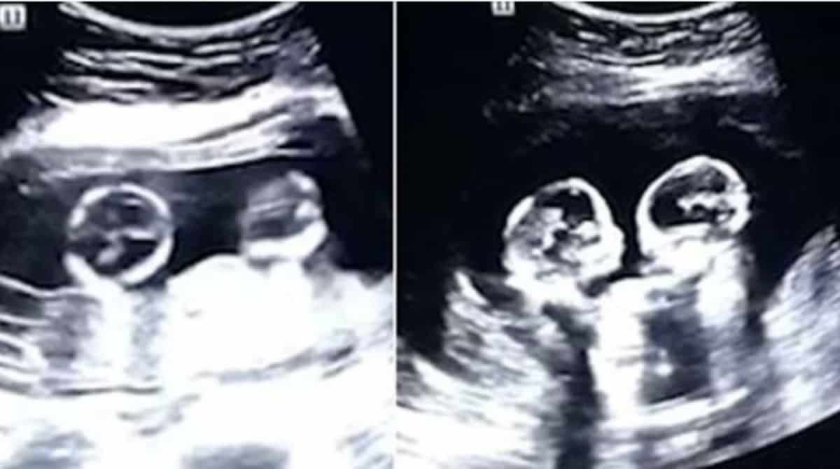 O Enigma do Bebê Fantasma no Hospital da Mulher Mariska Ribeiro: Mãe Busca Respostas Após Parto Traumático